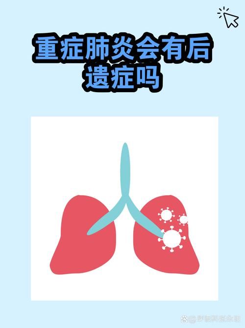 31省市新增重症19例均在浙江杭州西湖区(杭州重症肺炎病例)