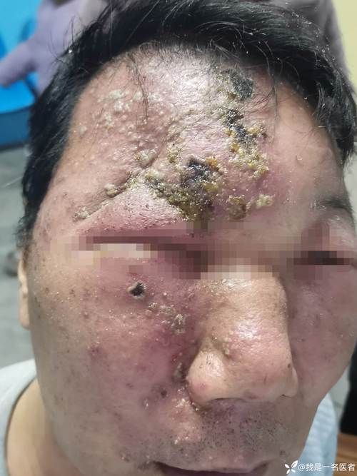 巴里坤哈萨克自治县昨日新增无症状感染者18例_巴里坤哈萨克自治县怎么样
