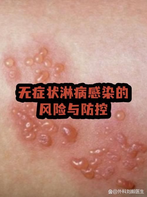 31省市新增无症状感染者10例安徽8例(安徽无症状感染者轨迹)