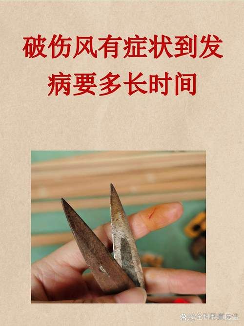 【贵州黔西南布依族苗族自治州兴义4月29日新增无症状感染者16例,贵州省兴义市有没有新型肺炎】