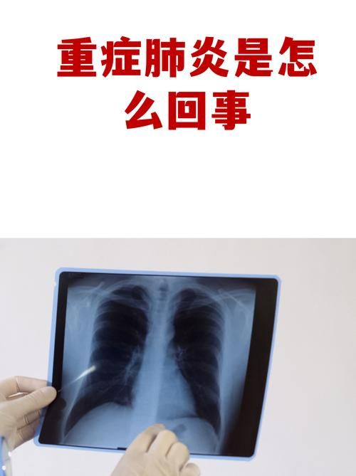 【吉林辽源西安区8月11日无新增重症,吉林辽源新增新型肺炎】