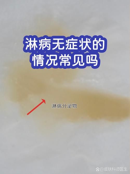 【31省增10例无症状感染者_无症状感染者轨迹信息公布】